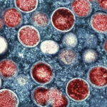 HKU5-CoV-2: New Bat Virus Discovered in Wuhan—Should We Be Worried?